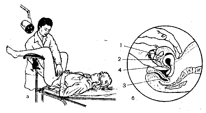Гинекологический массаж. Техника выполнения